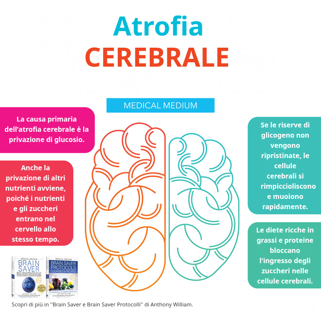 Atrofia cerebrale: le cellule del cervello private di glucosio e glicogeno