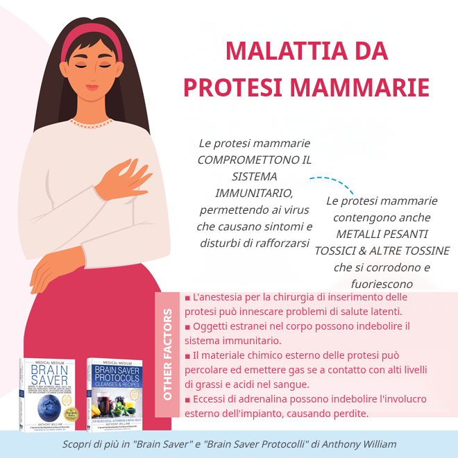 Malattia da protesi al seno: sintomi neurologici e ruolo dei virus