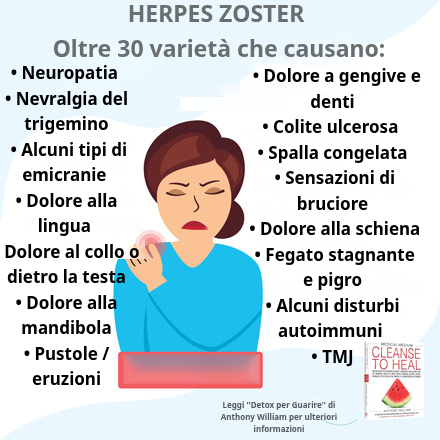 Varianti di herpes zoster con e senza eruzioni cutanee