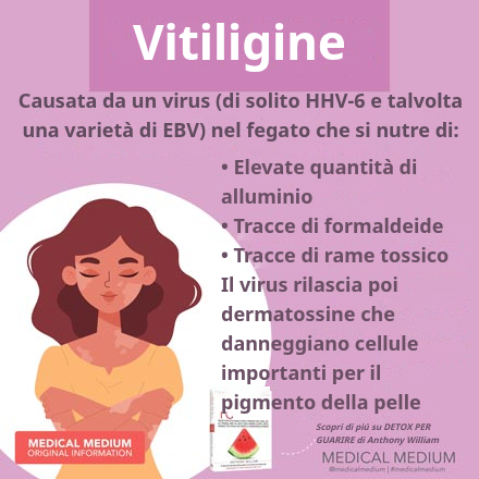 Cellule del pigmento cutaneo danneggiate dalle dermatossine nella vitiligine